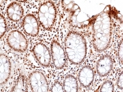 IHC staining of FFPE human colon tissue with recombinant phosphorylated JNK antibody at 1:100.