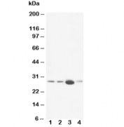Western blot testing of Calbindin antibody and Lane 1:  rat brain;  2: rat brain;  3: rat kidney;  4: rat lung tissue lysate. Expected molecular weight: 27-28 kDa.