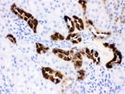 IHC testing of FFPE rat kidney with Calbindin antibody. HIER: Boil the paraffin sections in pH 6, 10mM citrate buffer for 20 minutes and allow to cool prior to testing.