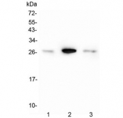 Western blot testing of Calbindin antibody and Lane 1:  rat brain;  2: rat brain;  3: mouse brain tissue lysate. Expected molecular weight: 27-28 kDa.