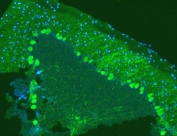 Immunofluorescent testing of FFPE mouse brain with Calbindin antibody (green) and DAPI (blue). HIER: Boil the paraffin sections in pH 6, 10mM citrate buffer for 20 minutes and allow to cool prior to testing.