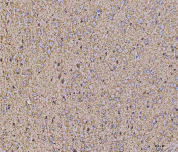 IHC staining of FFPE mouse brain tissue with Calcineurin A antibody. HIER: boil tissue sections in pH8 EDTA for 20 min and allow to cool before testing.