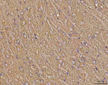 IHC staining of FFPE rat brain tissue with Calcineurin A antibody. HIER: boil tissue sections in pH8 EDTA for 20 min and allow to cool before testing.