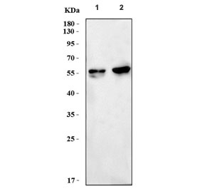 Western blot testing of 1) rat brain and 2) mouse brain tissue lysate with Calcineurin A antibody. Expected molecular weight ~59 kDa.