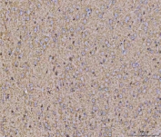 IHC staining of FFPE mouse brain tissue with Calcineurin A antibody. HIER: boil tissue sections in pH8 EDTA for 20 min and allow to cool before testing.