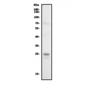 Western blot testing of human A549 cell lysate with Cathepsin L antibody. Expected molecular weight: 38-41 kDa with multiple smaller processed/active forms.