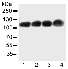 Western blot testing of CEA antibody and Lane 1: Recombinant human CEA protein 10ng; Lane 2: 5ng; 3: 2.5ng; 4: 1.25ng~