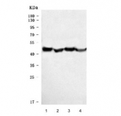 Western blot testing of human 1) placenta, 2) A431, 3) Caco-2 and 4) HepG2 cell lysate with Cytokeratin 18 antibody. Predicted molecular weight ~48 kDa.