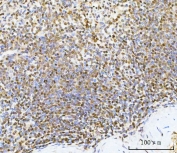 IHC staining of FFPE human spleen tissue with c-Myc antibody. HIER: boil tissue sections in pH8 EDTA for 20 min and allow to cool before testing.