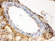 IHC testing of frozen mouse kidney tissue with COL3A1 antibody. 
