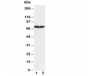 Western blot testing of COL3A1 antibody and Lane 1:  HT1080;  2: COLO320 cell lysate. Expected molecular weight ~139 kDa, observed here at ~70 kDa.