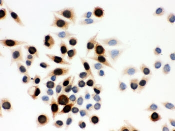 ICC testing of human SMMC-7721 cells with Cyclin A antibody.