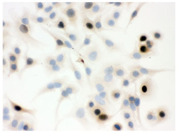 ICC testing of human A549 cells with Cyclin A antibody.