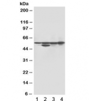 Western blot testing of 1) rat skeletal muscle, 2) rat heart, 3) mouse skeletal muscle and 4) mouse heart with Desmin antibody. Predicted molecular weight ~54 kDa.