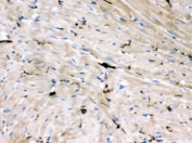 IHC testing of FFPE rat heart tissue with GAP43 antibody. HIER: steamed with pH6 citrate buffer, HRP-staining.