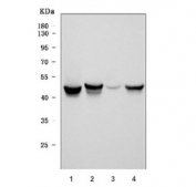 Western blot testing of 1) human U-251, 2) rat brain, 3) rat C6 and 4) mouse brain tissue with GFAP antibody. Predicted molecular weight ~50 kDa.