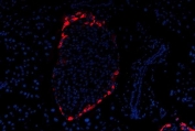 Immunofluorescent staining of FFPE mouse pancreas tissue with Glucagon antibody (red) and DAPI nuclear stain (blue). HIER: steam section in pH6 citrate buffer for 20 min.