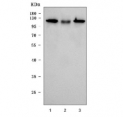 Western blot testing of human 1) RT-4, 2) T-47D and 3) A431 cell lysate with Involucrin antibody. Predicted molecular weight ~68 kDa but can be observed at up to ~140 kDa.