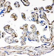 IHC staining of FFPE human placental tissue with Laminin antibody. HIER: boil tissue sections in pH8 EDTA for 20 min and allow to cool before testing.