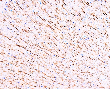 IHC-P: MAP1 antibody testing of rat brain tissue