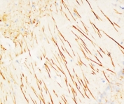 IHC-P testing of rat brain tissue with MAP2 antibody. HIER: Boil the paraffin sections in pH 6, 10mM citrate buffer for 20 minutes and allow to cool prior to testing.