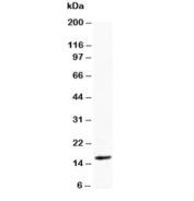 Western blot testing of Myoglobin antibody and rat skeletal muscle tissue lysate. Predicted molecular weight ~17 kDa.