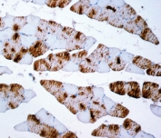 IHC staining of FFPE rat skeletal muscle tissue with Myosin antibody. HIER: boil tissue sections in pH8 EDTA for 20 min and allow to cool before testing.