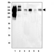 Western blot testing of 1) monkey heart, 2) monkey skeletal muscle, 3) rat heart, 4) rat skeletal muscle, 5) mouse heart and 6) mouse skeletal muscle tissue lysate with Myosin antibody.