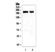 Western blot testing of 1) mouse skeletal muscle and 2) rat skeletal muscle tissue lysate with Myosin antibody.