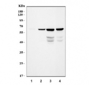 Western blot testing of 1) human SH-SY5Y, 2) human U-251, 3) rat brain and 4) mouse brain tissue lysate with Light Chain Neurofilament antibody. Predicted molecular weight: 62-68 kDa.