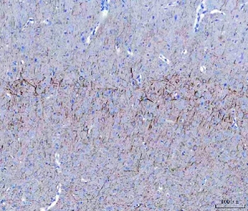 IHC staining of FFPE rat brain tissue with Light Chain Neurofilament antibody. HIER: boil tissue sections in pH8 EDTA for 20 min and allow to cool before testing.
