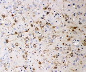 IHC-P: Neurofilament 200 antibody testing of rat brain tissue