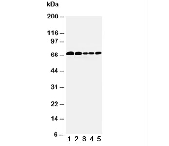 Western blot testing of Paxillin antibody and Lane 1: 293T; 2: HeLa; 3: MCF-7; 4: MM231; 5: Jurkat cell lysate