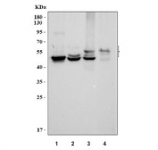 Western blot testing of 1) human NCL-H460, 2) human Hela, 3) human A431 and 4) mouse skin tissue lysate with pan Cytokeratin antibody.