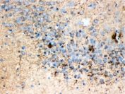 IHC testing of FFPE rat brain with Synaptophysin antibody. HIER: Boil the paraffin sections in pH 6, 10mM citrate buffer for 20 minutes and allow to cool prior to testing.