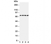 Western blot testing of Tau antibody and Lane 1:  rat brain (40ug);  2: rat brain (50ug);  3: mouse brain (40ug);  4: mouse brain (50ug). Expected molecular weight: 50-80 kDa.