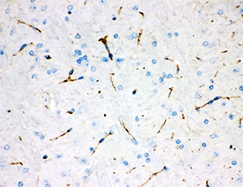 IHC staining of FFPE rat brain tissue with Tyrosine Hydroxylase antibody. HIER: boil tis
