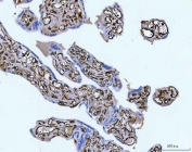 IHC staining of FFPE human placental tissue with Vimentin antibody. HIER: boil tissue sections in pH8 EDTA for 20 min and allow to cool before testing.