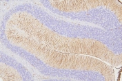 IHC staining of FFPE rat brain tissue with Vimentin antibody. HIER: boil tissue sections in pH8 EDTA for 20 min and allow to cool before testing.