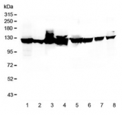 Western blot testing of 1) human HeLa, 2) human HepG2, 3) monkey COS-7, 4) human U-87 MG, 5) rat PC-12, 6) rat RH35, 7) mouse HEPA1-6, and 8) mouse NIH3T3 lysate with Vinculin antibody. Predicted molecular weight ~124 kDa.