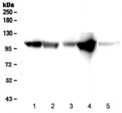 Western blot testing of 1) rat heart, 2) rat skeletal muscle, 3) mouse heart, 4) mouse skeletal muscle and 5) human placenta lysate with alpha-Actinin antibody at 0.5ug/ml. Predicted molecular weight ~105 kDa.