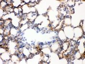 IHC testing of FFPE mouse lung tissue with alpha-Actinin antibody at 1.5 ug/ml. Required HIER: boil the sections in 10mM Citrate buffer, pH6, and allow to cool prior to staining.