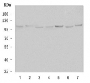 Western blot testing of 1) human SH-SY5Y, 2) human U-87 MG, 3) human MCF7, 4) human 293T, 5) rat brain, 6) rat C6 and 7) mouse brain tissue lysate with Alpha-Adaptin antibody. Predicted molecular weight ~108 kDa.