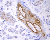 IHC staining of FFPE human placental tissue with ACTA2 antibody. HIER: boil tissue sections in pH8 EDTA for 20 min and allow to cool before testing.