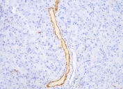 IHC staining of FFPE mouse pancreas tissue with ACTA2 antibody. HIER: boil tissue sections in pH8 EDTA for 20 min and allow to cool before testing.