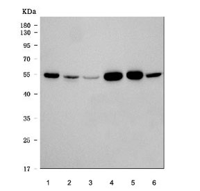Western blot testing of 1) human SH-SY5Y, 2) human Jurkat, 3) human A549, 4) rat brain, 5) mouse brain and 6) mouse thymus tissue lysate with Alpha Tubulin antibody. Predicted molecular weight ~50 kDa.~