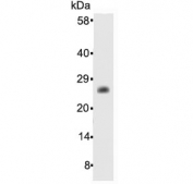 Western blot testing of human recombinant protein with Bcl-2 antibody at 0.5ug/ml. Predicted molecular weight ~26 kDa.