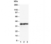 Western blot testing of EPO antibody and Lane 1:  Recombinant human protein 10ng;  2: 5ng;  3: 2.5ng. Predicted molecular weight: 18-34 kDa depending on glycosylation level.