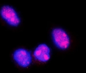 Immunofluorescent staining of FFPE human SiHa cells with FGF2 antibody (red) and DAPI nuclear stain (blue). HIER: steam section in pH6 citrate buffer for 20 min.