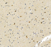 IHC staining of FFPE human brain tissue with FGF2 antibody, HRP-secondary and DAB substrate. HIER: boil tissue sections in pH8 EDTA for 20 min and allow to cool before testing.